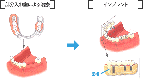 イメージ図